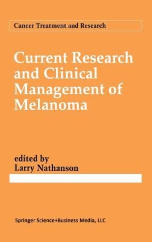 How We Treat Melanoma